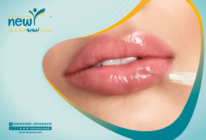 افضل دكتور فيلر شفايف بالرياض